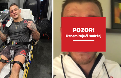 UFC masakr: Poirier je Hookera čak 131 put pogodio u glavu, a obojica su završila u bolnici...