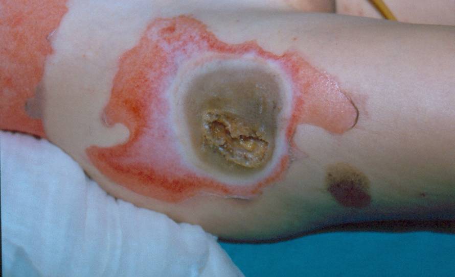 Evo zašto su zabranili petarde: Stravične snimke iz Klaićeve