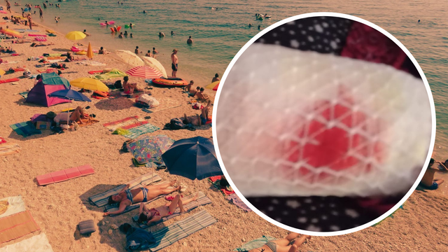 Pas napao ženu na plaži kraj Splita: "Izgrizao je dok je bila s unucima na moru. U šoku smo"