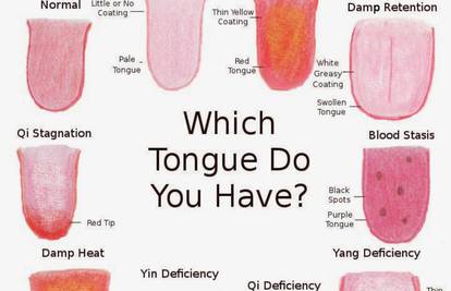 Isplazite jezik za dijagnozu - boja otkriva što vam nedostaje