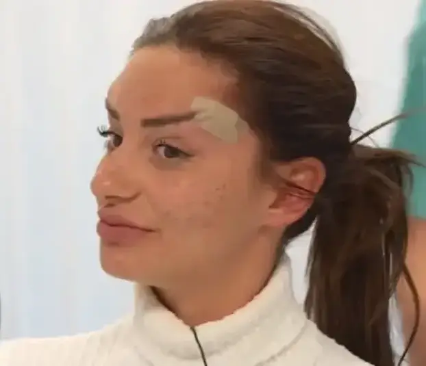 Na istog se estetskog kirurga žalila i Kristina Mandarina. Pogledajte kako je izgledala