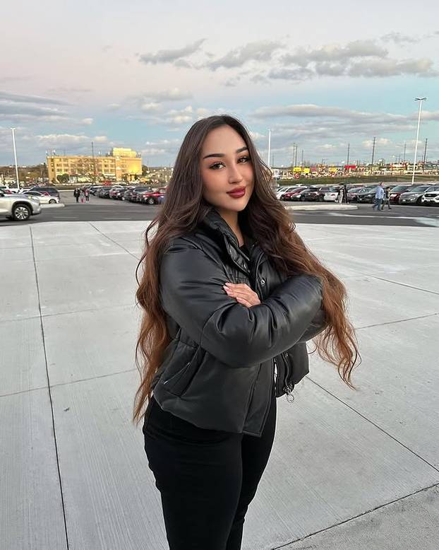 FOTO Ukrajinsku ljepoticu grudi su proslavile, a sada ih želi smanjiti: 'Svi bulje u mene'