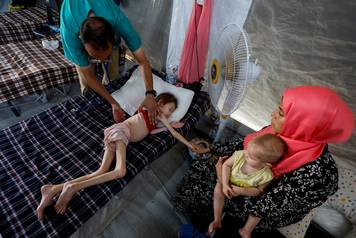 FILE PHOTO: Malnourished Palestinian children receive treatment at the IMC field hospital in Deir Al-Balah, central Gaza Strip