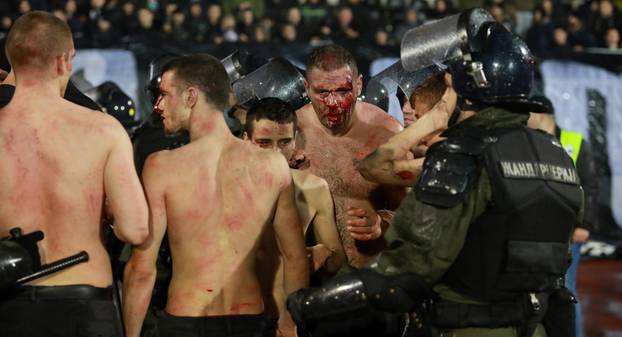 Police escort the soccer fans injured during the fights at a match between Red Star and Partizan in Belgrade