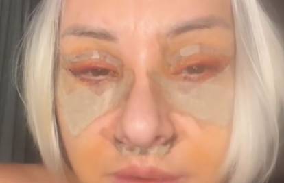 Danijela Dvornik otišla na 'face lift': Evo koliko taj zahvat košta