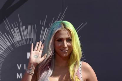 Kesha o bolesti: Prešla sam na tamnu stranu i prestala jesti