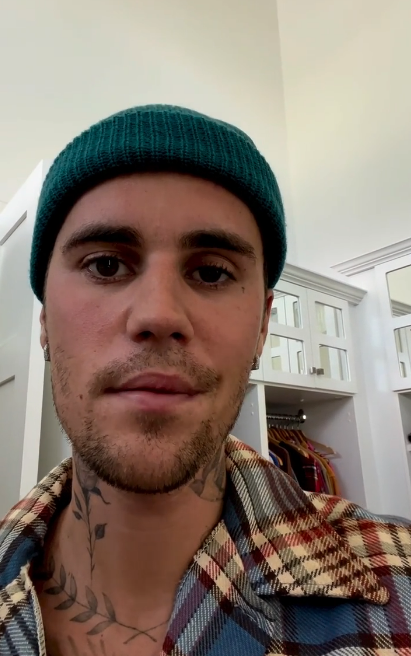 Justin Bieber oglasio se nakon što mu je lice paralizirano