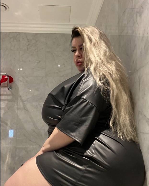 FOTO Stražnjica mi teži 45 kila, no već imam u planu sljedeću operaciju, želim imati najveću!