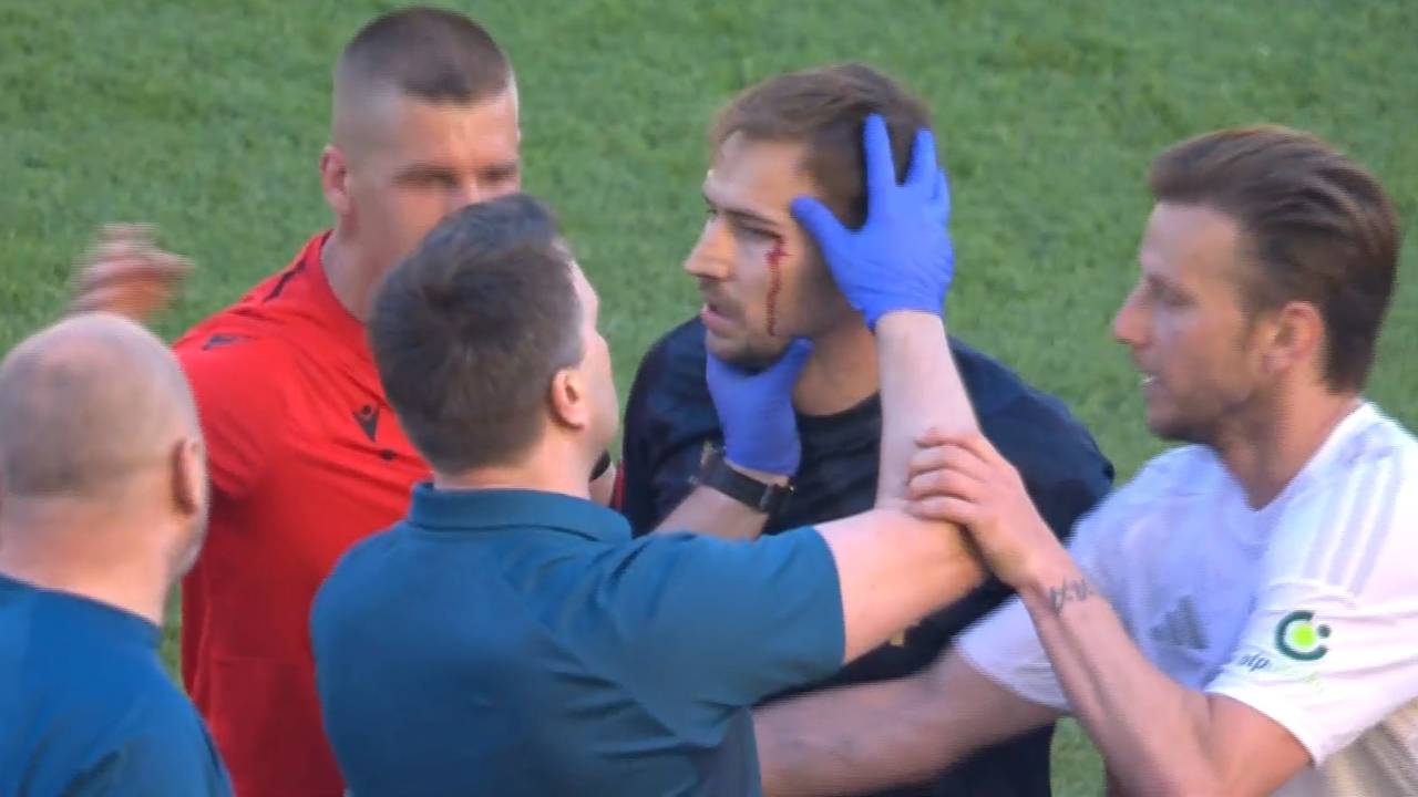 Dinamov liječnik pregledavao krvavog Roga, Rakitić ga tjerao