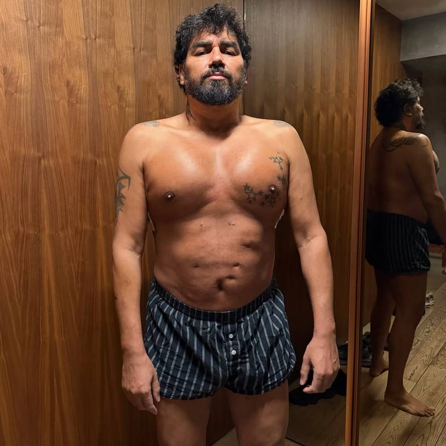 Azis pokazao natečena prsa nakon ugradnje silikona: Prije 3 godine snimio je duet sa Sevom