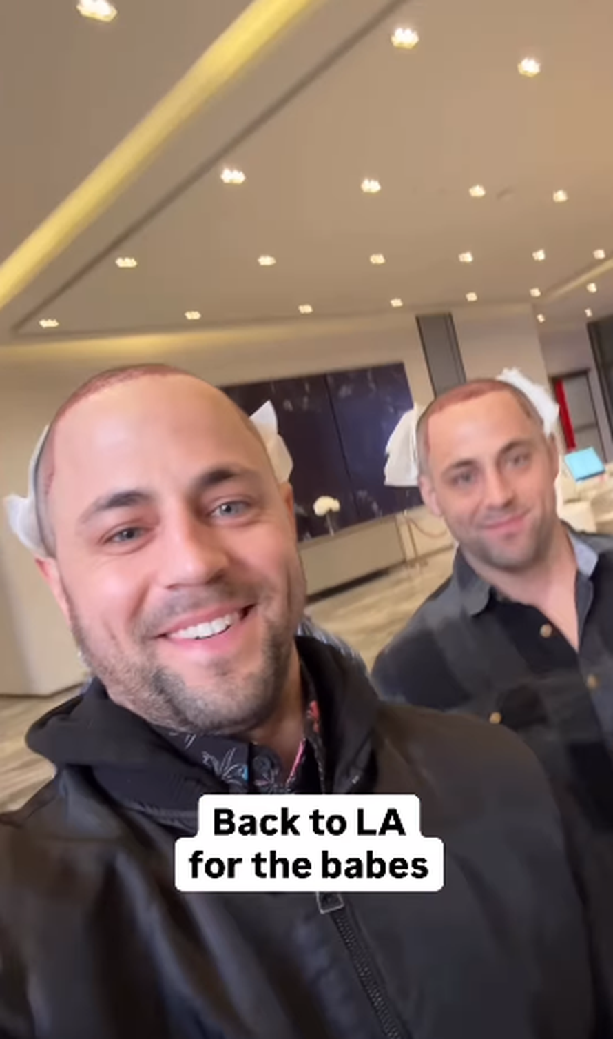 Trojčeki otputovali u Tursku na transplantaciju kose: 'Ne može samo jedan imati dobru frizuru'