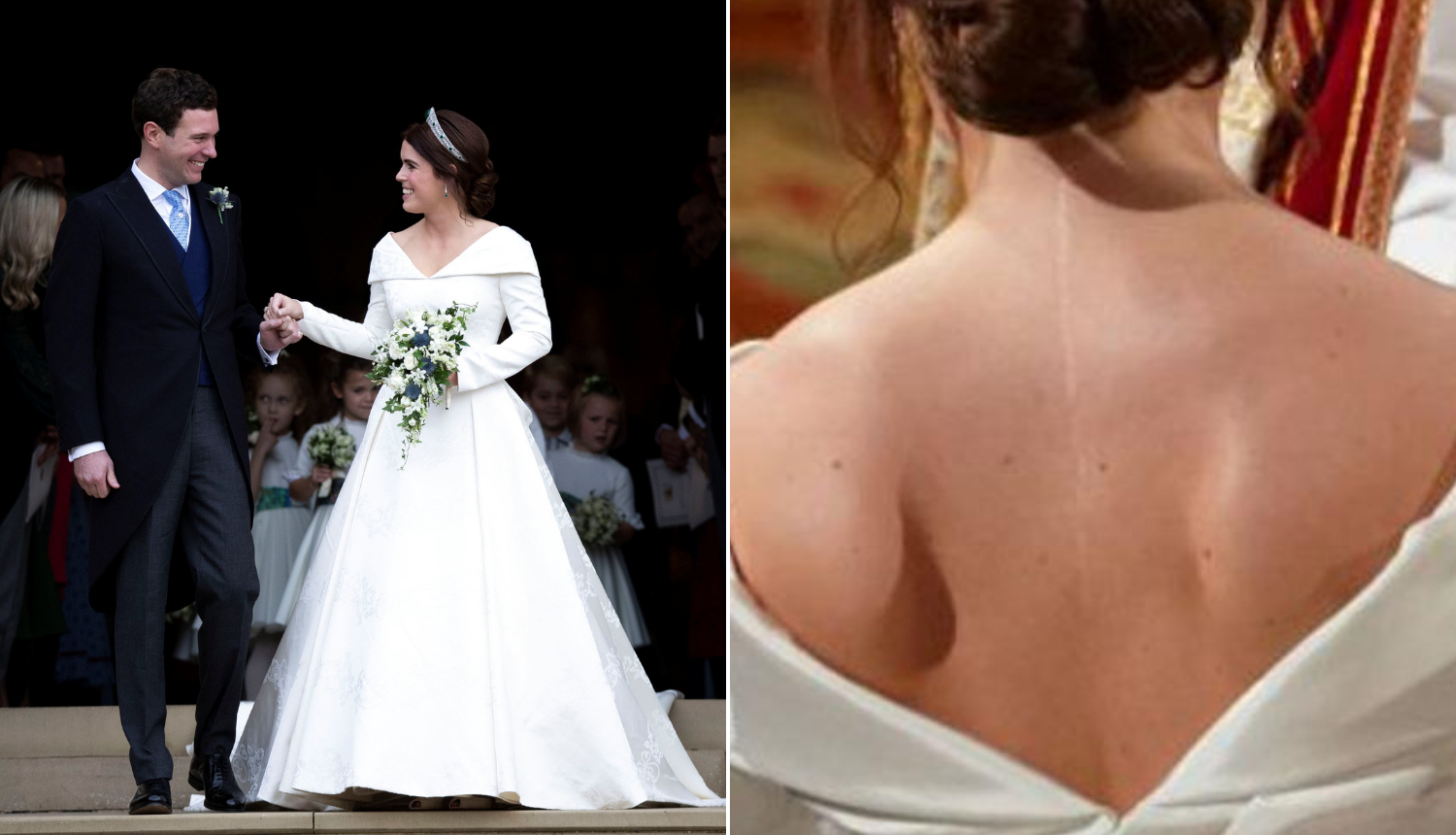 Princeza je ponosna na ožiljak: Odjenula haljinu otvorenih leđa