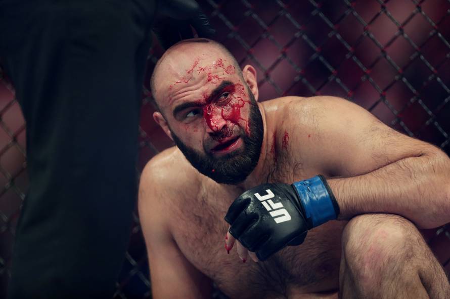 Uf, to je bilo gadno: Brutalnim laktom slomio mu nos i slavio