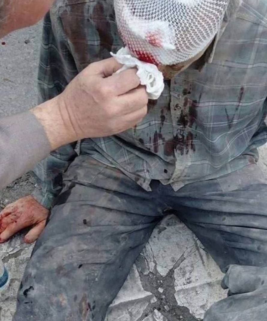 Civilians Injured and Vehicles Ablaze as US and Israel Launch Strikes on Iran - 28 Feb 2026