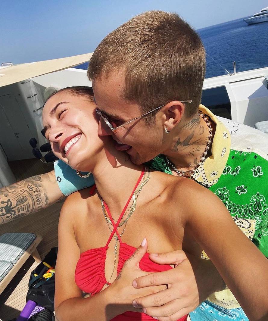 Hailey Bieber hospitalizirali radi problema na mozgu, liječnici tvrde da su povezani s koronom