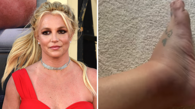 Britney Spears nakon incidenta pokazala natečeno stopalo: 'Za sve je kriva moja mama...'