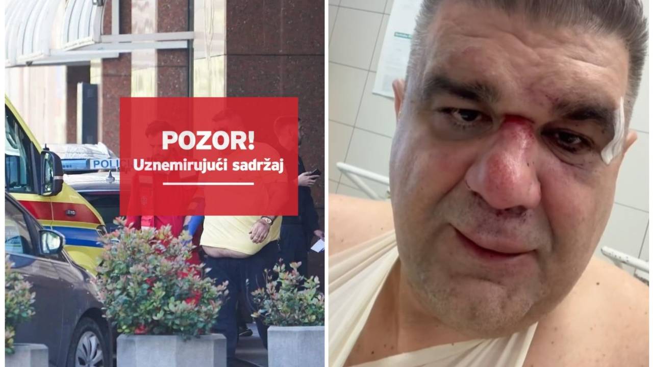 Oglasili se srpski menadžeri koji su se tukli u Zagrebu. Mirković: Ruka je slomljena na tri mjesta!