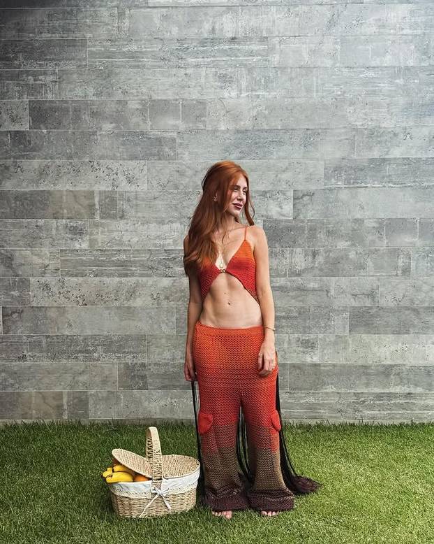 FOTO Posebna ljepota: Milijuni ljudi obožavaju njezine pjegice