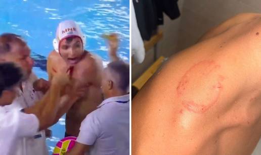 VIDEO Finale vaterpola obilje&zcaron;io skandal! Stupar pokazivao trag ugriza, Savi&cacute; poludio na suce
