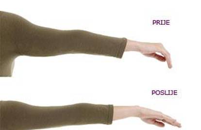 Najlonke za ruke mišićima i koži vraćaju čvrstoću