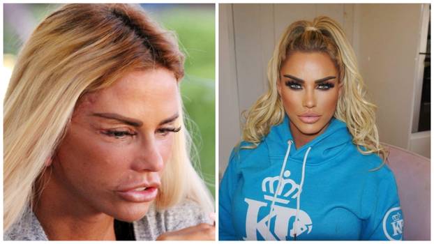 Katie ne zna ni sama koliko je puta išla pod nož, da bi sada glumila zlu sestru i Pepeljugi