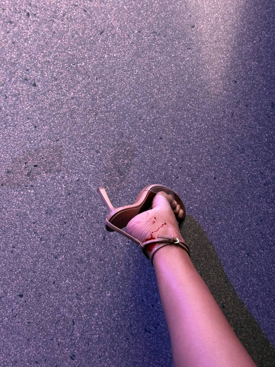 Misica Laura Gnjatović pokazala krvavo stopalo nakon zadarske revije: 'Ovo me zaboljelo...'