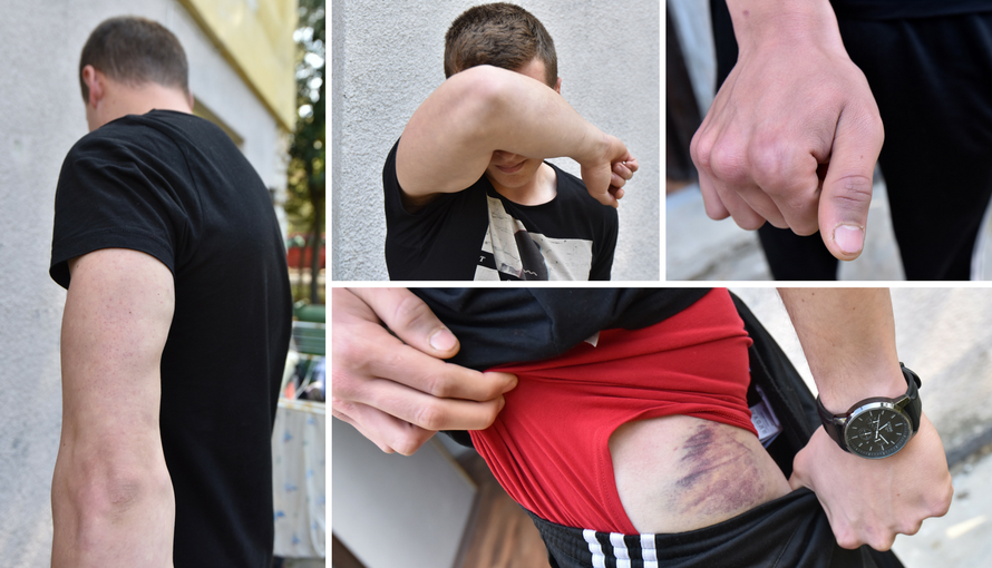 'Mlađi su čuvali stražu dok me stariji policajac tukao i prijetio'