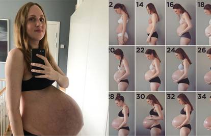 Nevjerojatne fotke: Ovako vam trbuh raste dok nosite trojke!