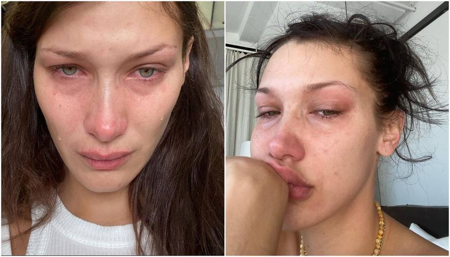 Bella Hadid priznala: 'Stalno sam se vraćala muškarcima i ženama koji su me zlostavljali'