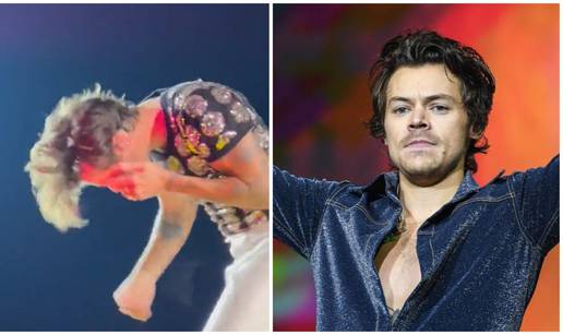 I Harry Styles je postao žrtva bizarnog trenda na koncertima: Pogodili su ga nečime u glavu