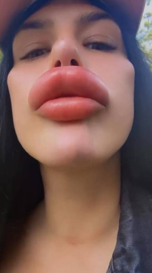 Woman with Britain's ‘biggest lips’ injects filler at HOME after being ‘refused’ by professionals – despite only taking six-week online course