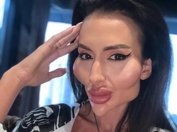 Žena s 'najvećim obrazima na svijetu' objavila fotografiju iz mladosti: 'Šok! Šteta ljepote'