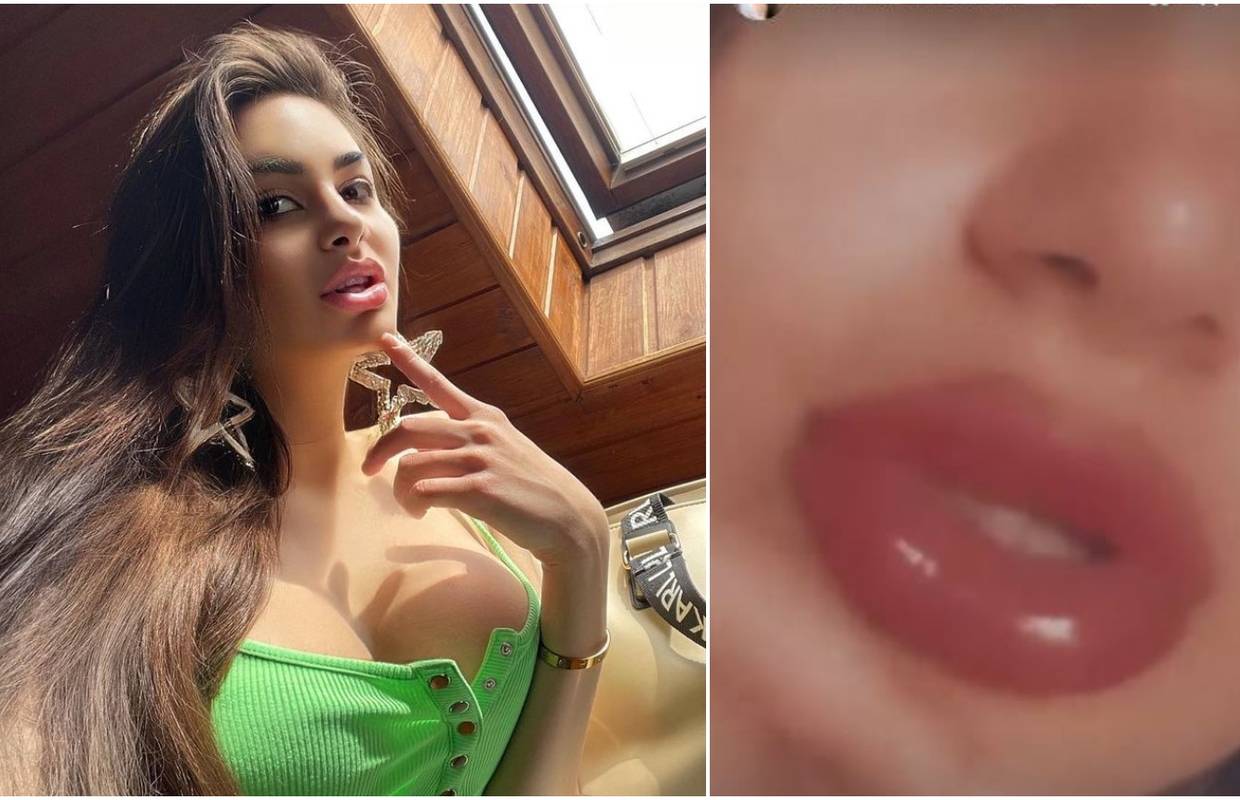 Kristina Mandarina se pohvalila usnama nakon novog zahvata