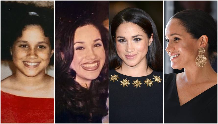 Od toga pobjeći ne može: I dalje se priča da je Meghan bila na operaciji i popravila nos, vilicu