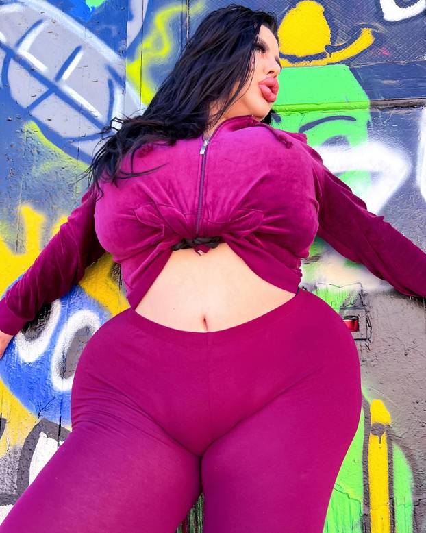 FOTO Stražnjica mi teži 45 kila, no već imam u planu sljedeću operaciju, želim imati najveću!