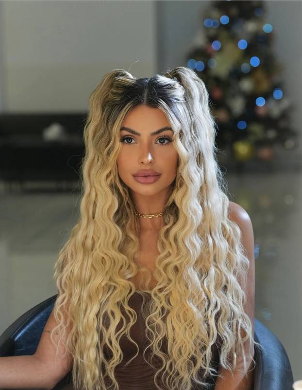 Potrošila milijun eura na izgled! 'Toliko sam lijepa da imam zabranu na dejt aplikacijama'