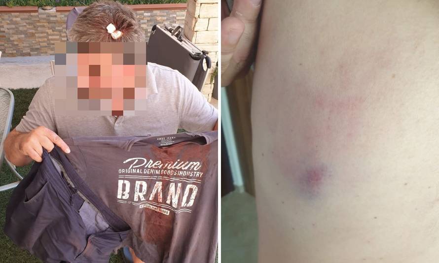 Pag: 'Smetalo im je što pričamo na terasi. Zaskočili su me i mlatili pred ženom i djecom'