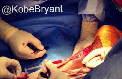 Uznemirujući sadržaj: Bryant objavio fotografiju s operacije