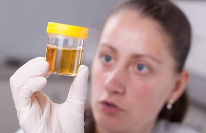Boja urina i hidracija: Test kako znati pijete li dosta vode ili ne