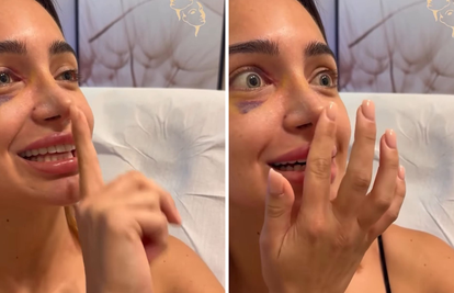 Laura snimala svoj novi nos pa ga slučajno udarila: 'Upsss...'
