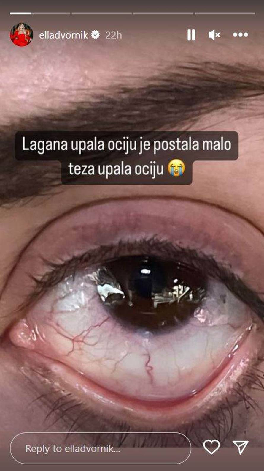 Ella Dvornik ima zdravstvenih problema: 'Ovo nije prvi put!'