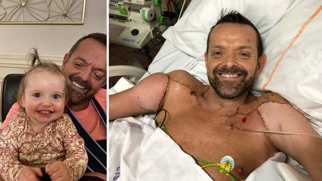 Prvom na svijetu transplantirali su mu ruke prije 16 mjeseci: 'Već sam dižem utege i bacam kuglu'
