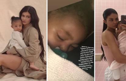 Kylie Jenner je provela dan u bolnici: Malena je imala alergiju