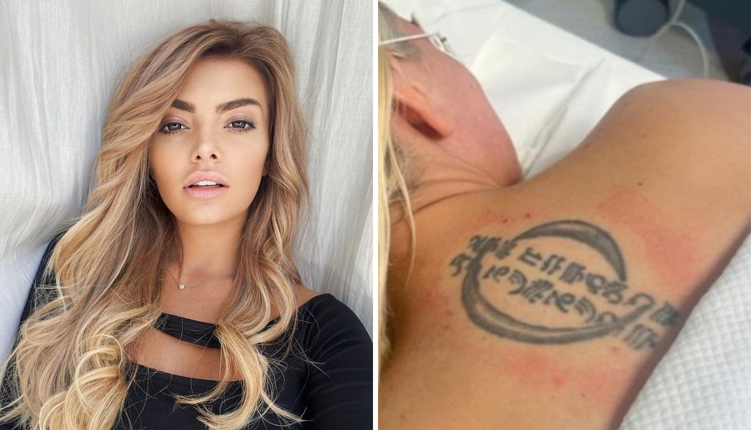 Ella Dvornik uklonila tetovažu na leđima: 'Ružna je kao smrt'