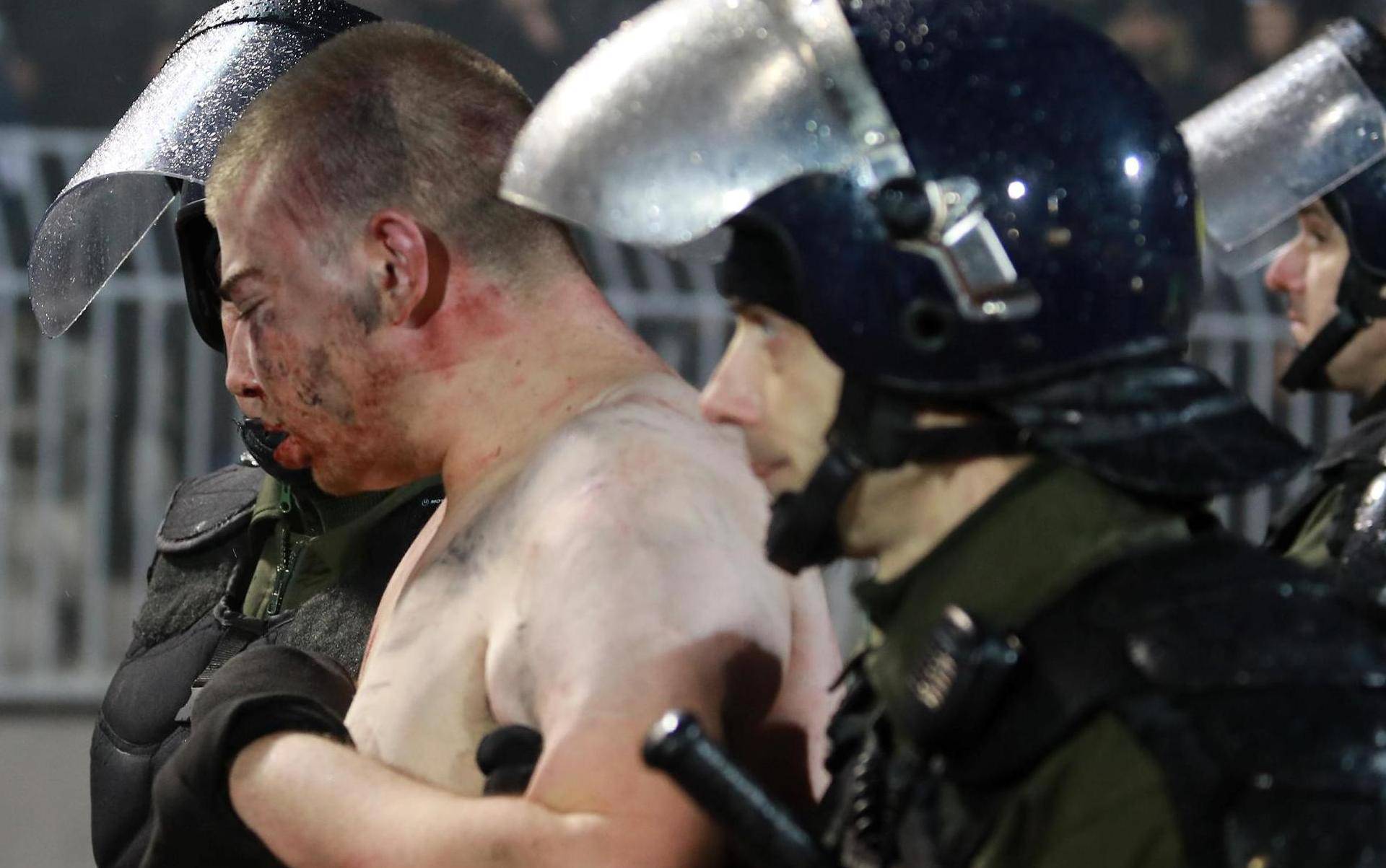 Police escort a soccer fan injured during the fights at a match between Red Star and Partizan in Belgrade