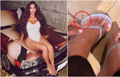 Kim pokazala šesti 'prst' na nozi o kojem se priča: 'Zbunjujuće je'