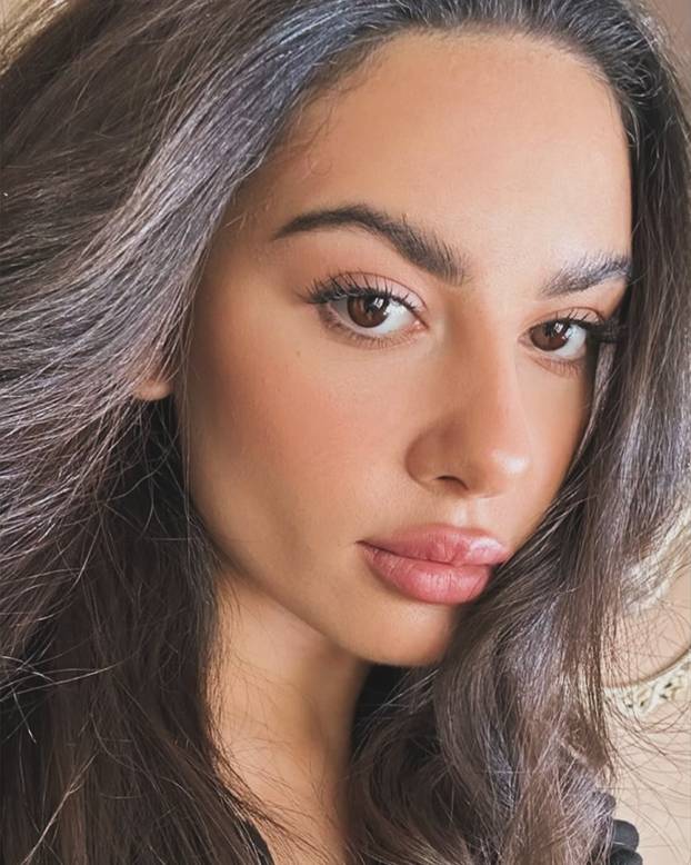 FOTO Putinova ljubimica imala je velike planove. Morala je na operaciju i tu joj je počeo pakao