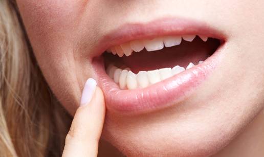 Dva signala u ustima koja su znak manjka vitamina B12
