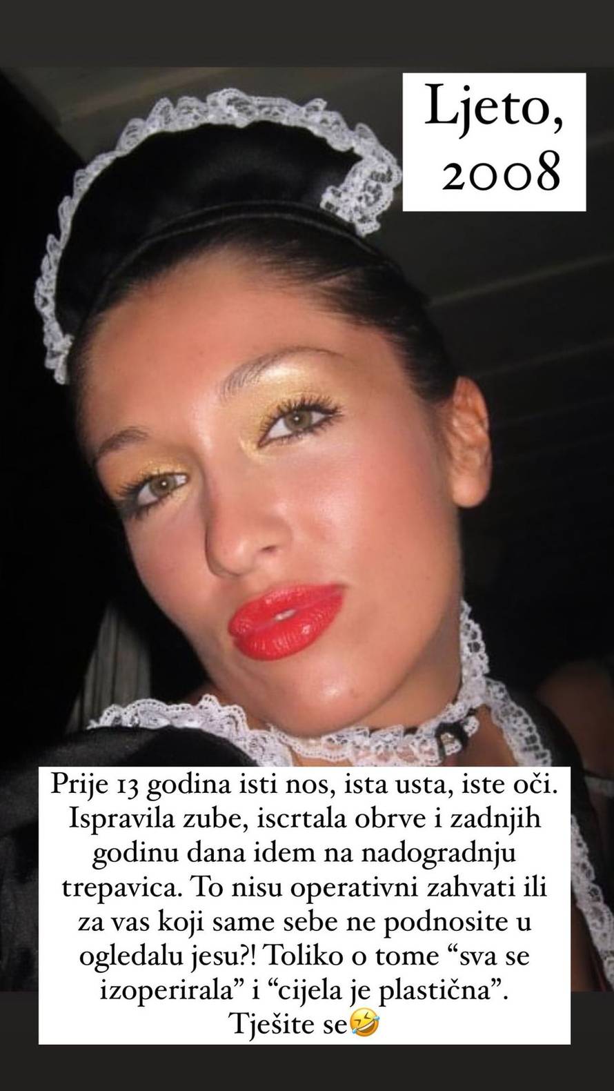 Hana Hadžiavdagić pokazala kako je prije izgledala: 'To nisu operativni zahvati'