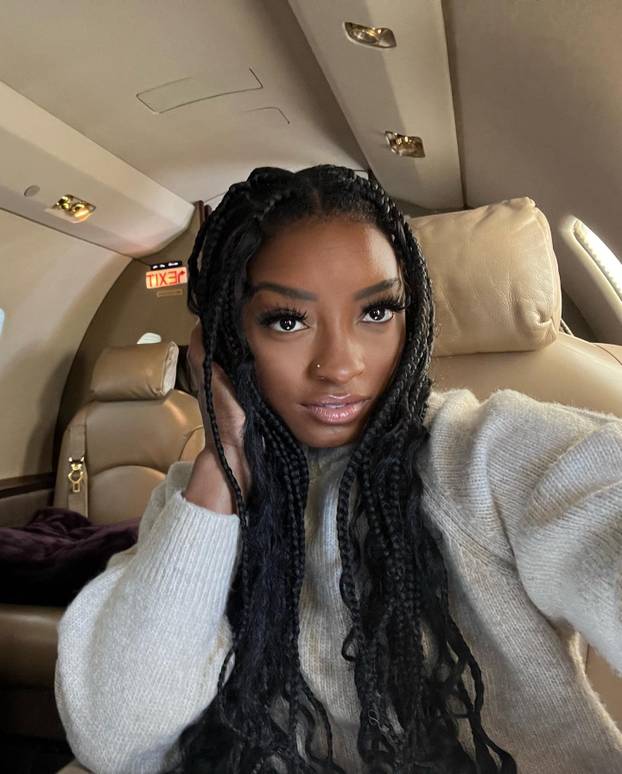 FOTO Olimpijska legenda: Imala sam tri plastične operacije. Za dvije ne biste mogli pogoditi...